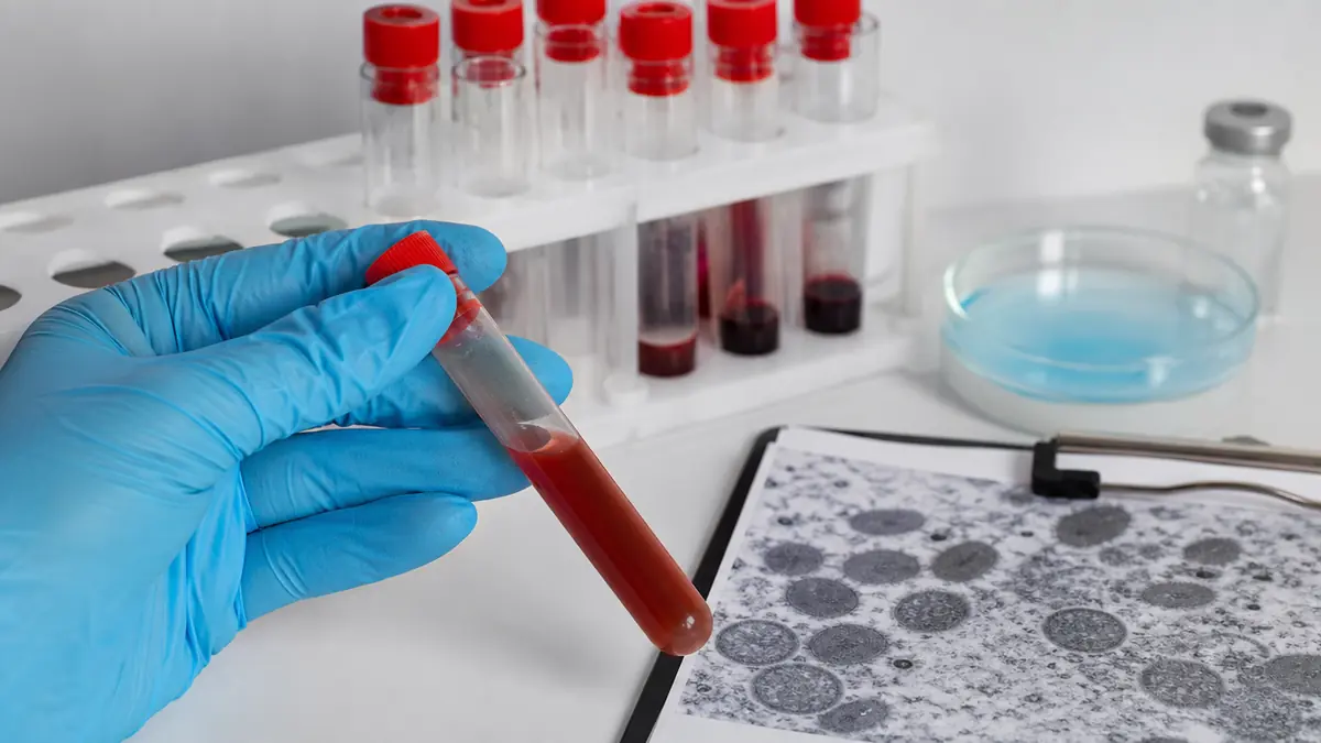 Public health laboratory materials for monkeypox information